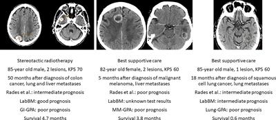 How we treat octogenarians with brain metastases